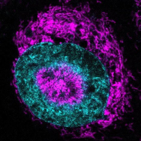 Células cancerosas obtienen energía extra al ser comprimidas, México planea su propio lenguaje