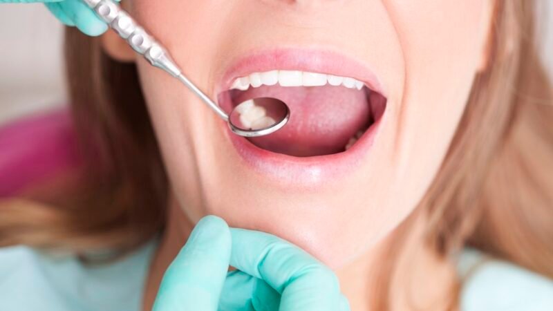 el pelo como posible solución para reparar dientes en una nueva investigación sobre caries