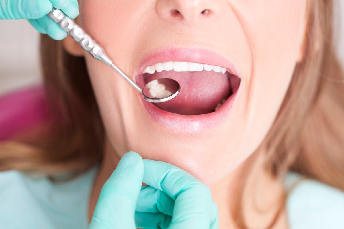 el pelo como posible solución para reparar dientes en una nueva investigación sobre caries