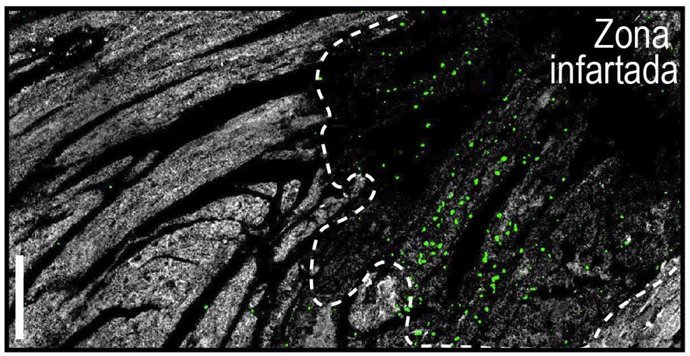 Estudio del CNIC revela que los infartos nocturnos son menos severos debido a ritmos circadianos