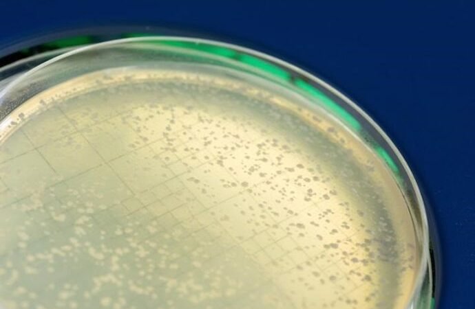 Las alteraciones en la genética de la levadura generan inestabilidad genómica asociada a