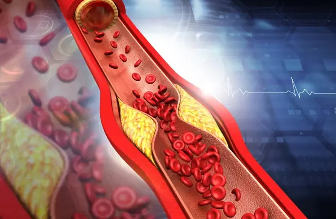 Crean un medicamento oral que disminuye los triglicéridos hasta un 38% sin afectar el colesterol