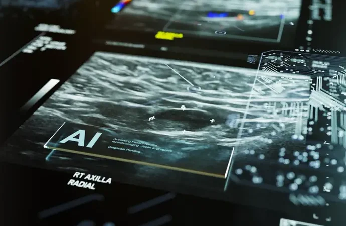 Un avance en biopsia líquida mejora la detección del cáncer de mama triple negativo temprano