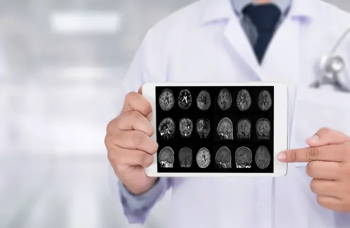 Enfermedades podrían anticipar el Alzheimer hasta 10 años antes y facilitar su prevención