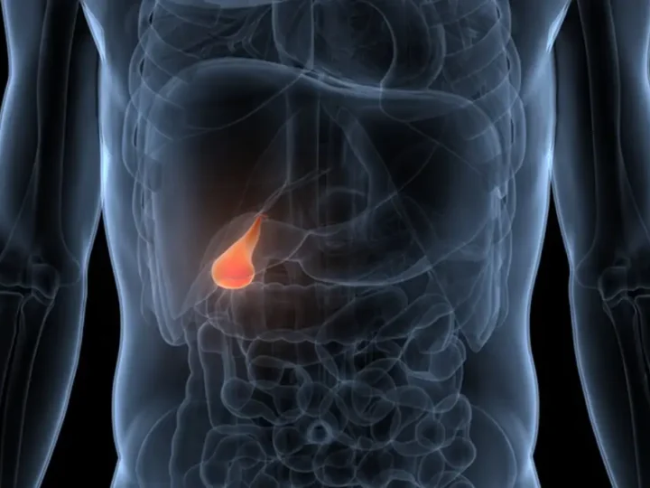 BiliSeq mejora la detección y el diagnóstico del cáncer de vías biliares significativamente